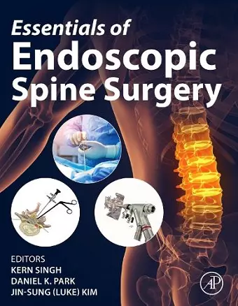 Essentials of Endoscopic Spine Surgery cover
