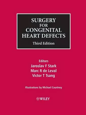 Surgery for Congenital Heart Defects cover