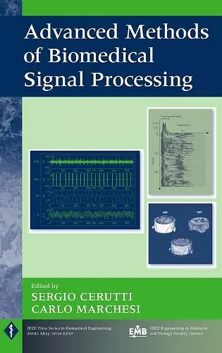 Advanced Methods of Biomedical Signal Processing cover