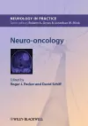 Neuro-oncology cover