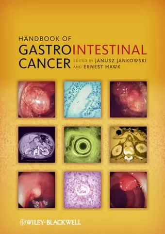 Handbook of Gastrointestinal Cancer cover