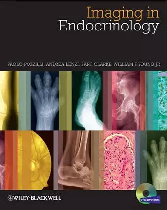 Imaging in Endocrinology cover