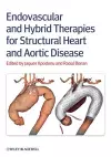 Endovascular and Hybrid Therapies for Structural Heart and Aortic Disease cover