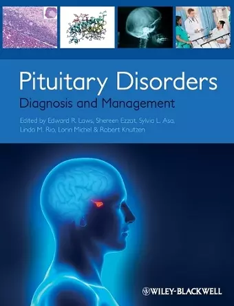 Pituitary Disorders cover