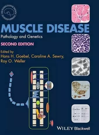 Muscle Disease cover