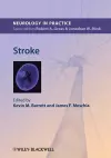 Stroke cover