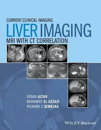 Liver Imaging cover