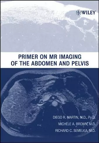 Primer on MR Imaging of the Abdomen and Pelvis cover