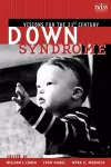 Down Syndrome cover
