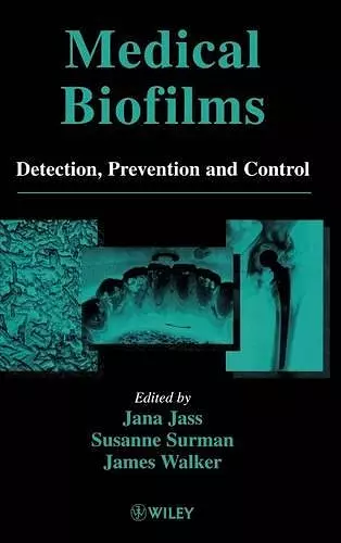 Medical Biofilms cover