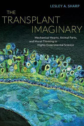 The Transplant Imaginary cover