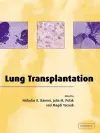 Lung Transplantation cover