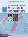 Uncommon Causes of Movement Disorders cover