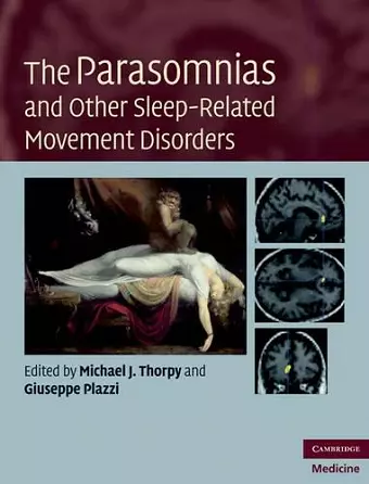 The Parasomnias and Other Sleep-Related Movement Disorders cover