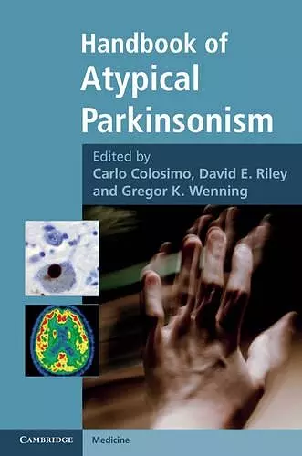 Handbook of Atypical Parkinsonism cover