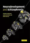 Neurodevelopment and Schizophrenia cover