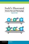 Stahl's Illustrated Chronic Pain and Fibromyalgia cover