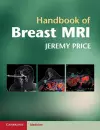 Handbook of Breast MRI cover