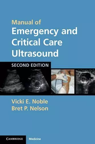 Manual of Emergency and Critical Care Ultrasound cover