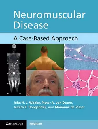 Neuromuscular Disease cover