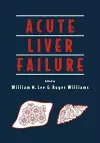 Acute Liver Failure cover