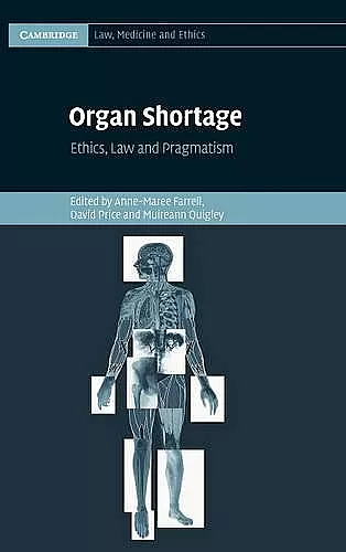 Organ Shortage cover
