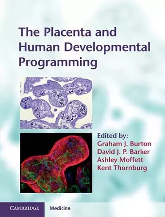 The Placenta and Human Developmental Programming cover