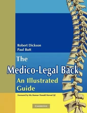 The Medico-Legal Back: An Illustrated Guide cover