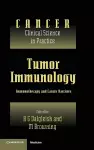 Tumor Immunology cover