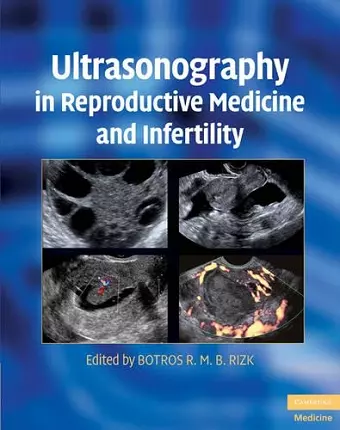 Ultrasonography in Reproductive Medicine and Infertility cover