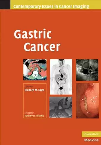 Gastric Cancer cover