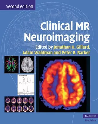 Clinical MR Neuroimaging cover