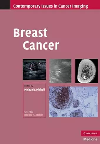 Breast Cancer cover