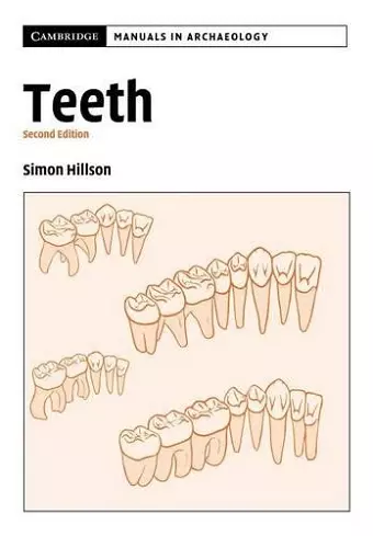 Teeth cover