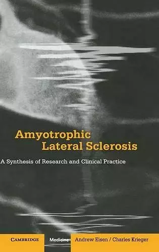 Amyotrophic Lateral Sclerosis cover