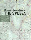 Illustrated Pathology of the Spleen cover