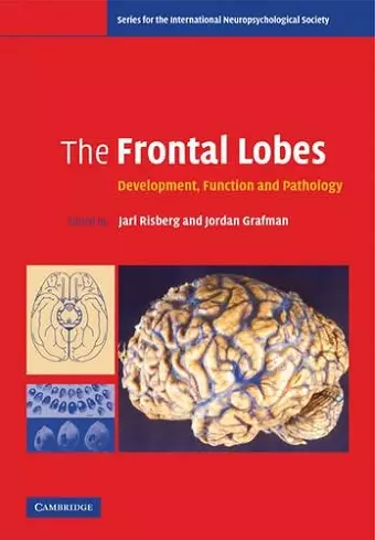 The Frontal Lobes cover