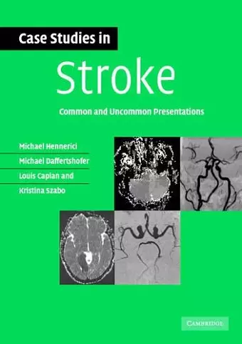 Case Studies in Stroke cover