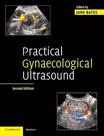 Practical Gynaecological Ultrasound cover