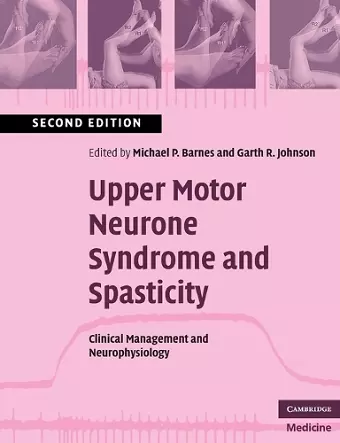 Upper Motor Neurone Syndrome and Spasticity cover