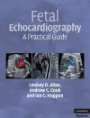 Fetal Echocardiography cover
