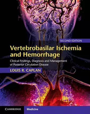 Vertebrobasilar Ischemia and Hemorrhage cover