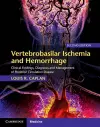 Vertebrobasilar Ischemia and Hemorrhage cover