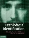 Craniofacial Identification cover