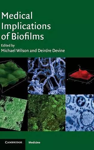 Medical Implications of Biofilms cover