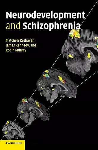 Neurodevelopment and Schizophrenia cover