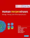 Human Herpesviruses cover