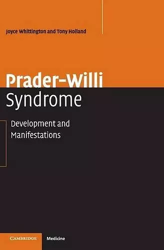 Prader-Willi Syndrome cover