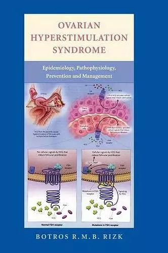 Ovarian Hyperstimulation Syndrome cover