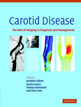 Carotid Disease cover